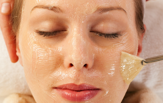 interventi di peeling chimico