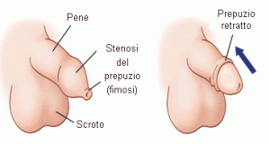 Anatomia setto nasale