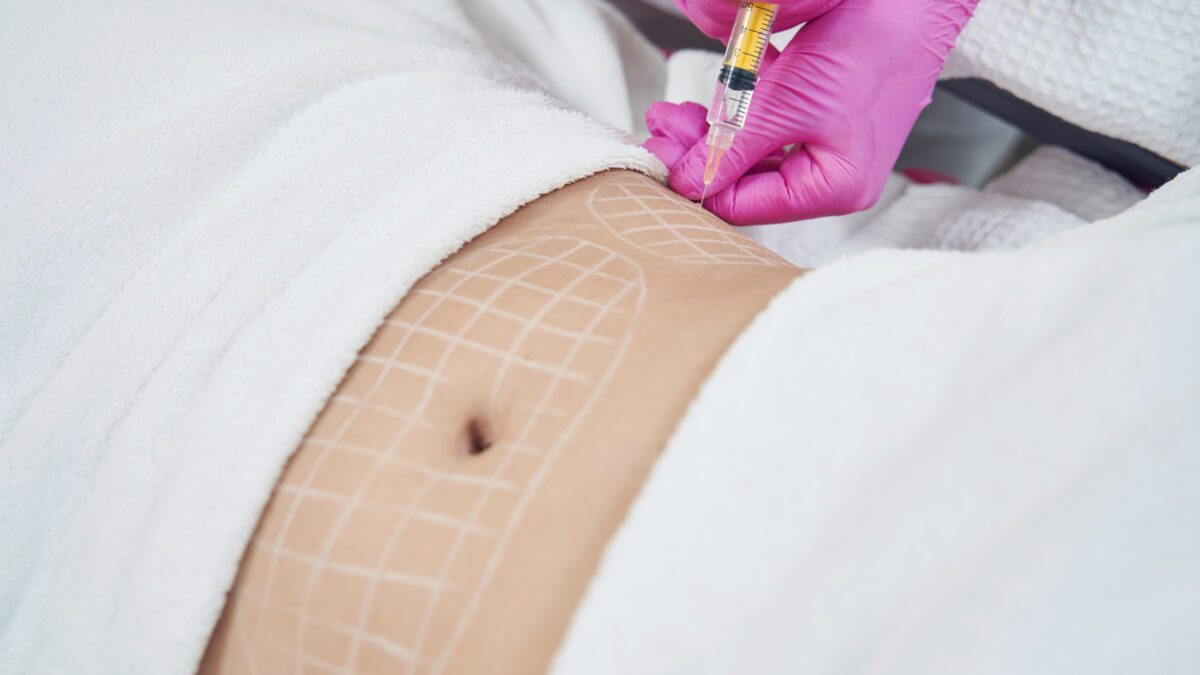 lipofilling a verona